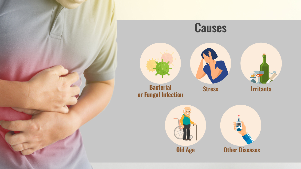 10 Best Homeopathic Medicine For Gastritis Causes Treatment