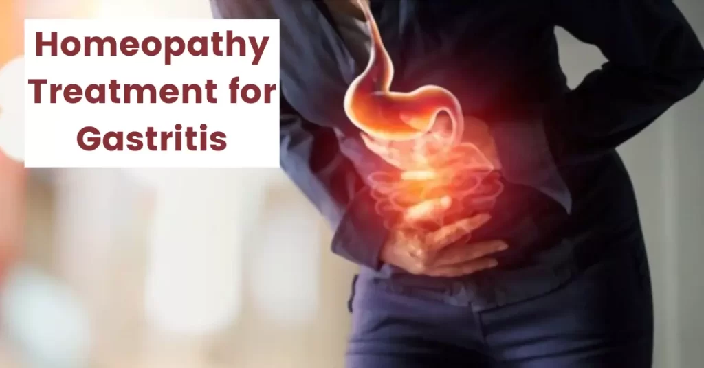 Homeopathic Medicine for Gastritis - Causes, Symptoms and Treatment