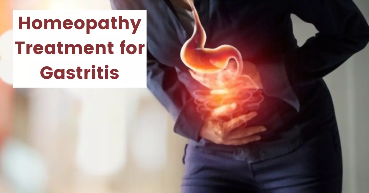 Homeopathic Medicine for Gastritis - Causes, Symptoms and Treatment
