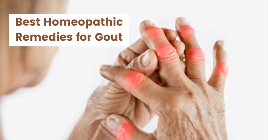 Homeopathy for Gout - Causes, Symptoms and Top 10 Medicines