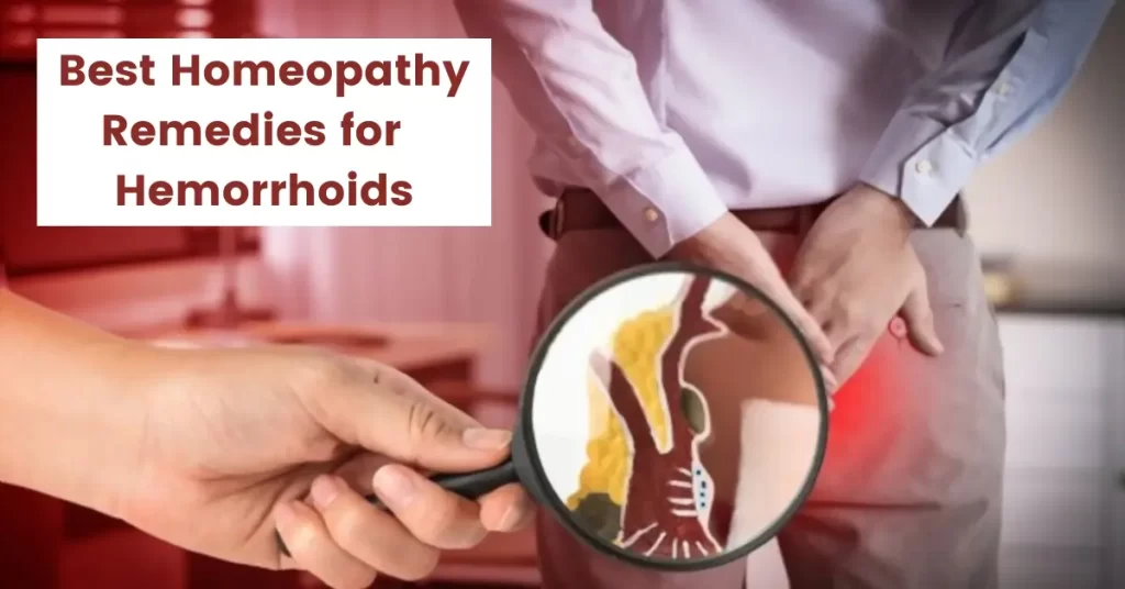 Best Homeopathic Remedy for Hemorrhoids - Causes and Cure