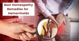 Best Homeopathic Remedy for Hemorrhoids – Causes & Cure