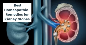 Homeopathic Remedies for Kidney Stone - Causes and Cure