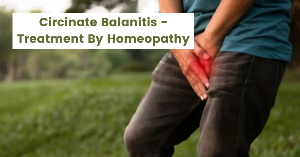 Circinate Balanitis - Causes and Best 10 Homeopathic Medicines
