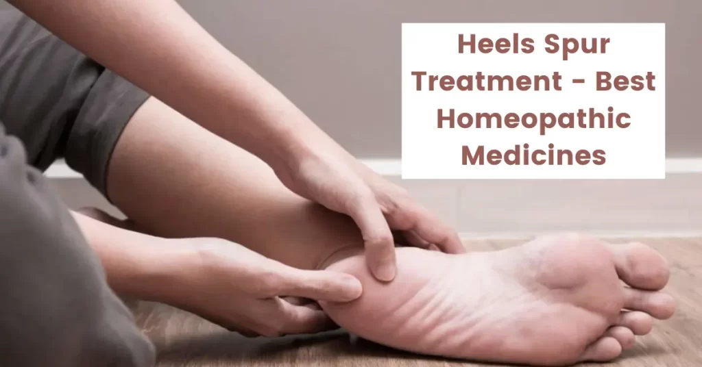Heels Spur Treatment - Best 12 Homeopathic Medicines
