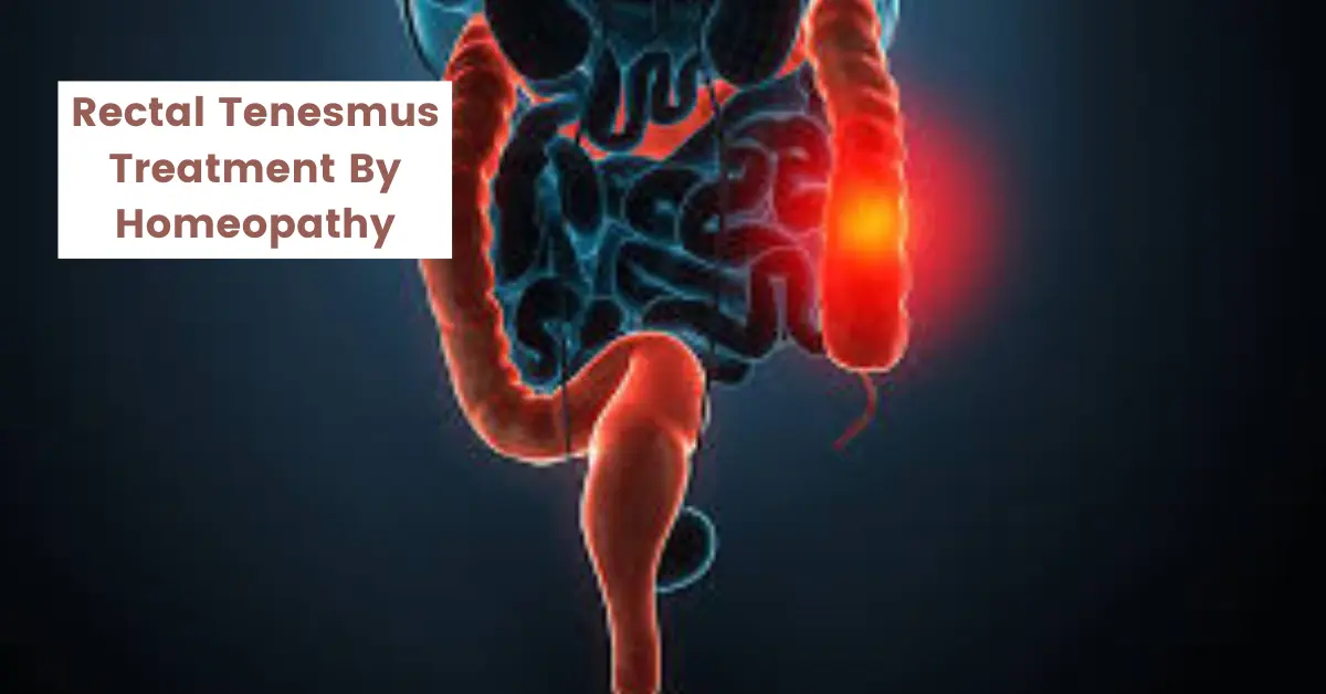 Rectal Tenesmus - Causes and Best Treatment by Homeopathy