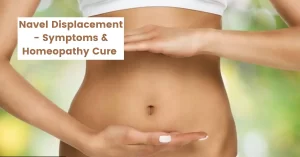 Navel Displacement, Pain - Symptoms, Causes and Homeopathy