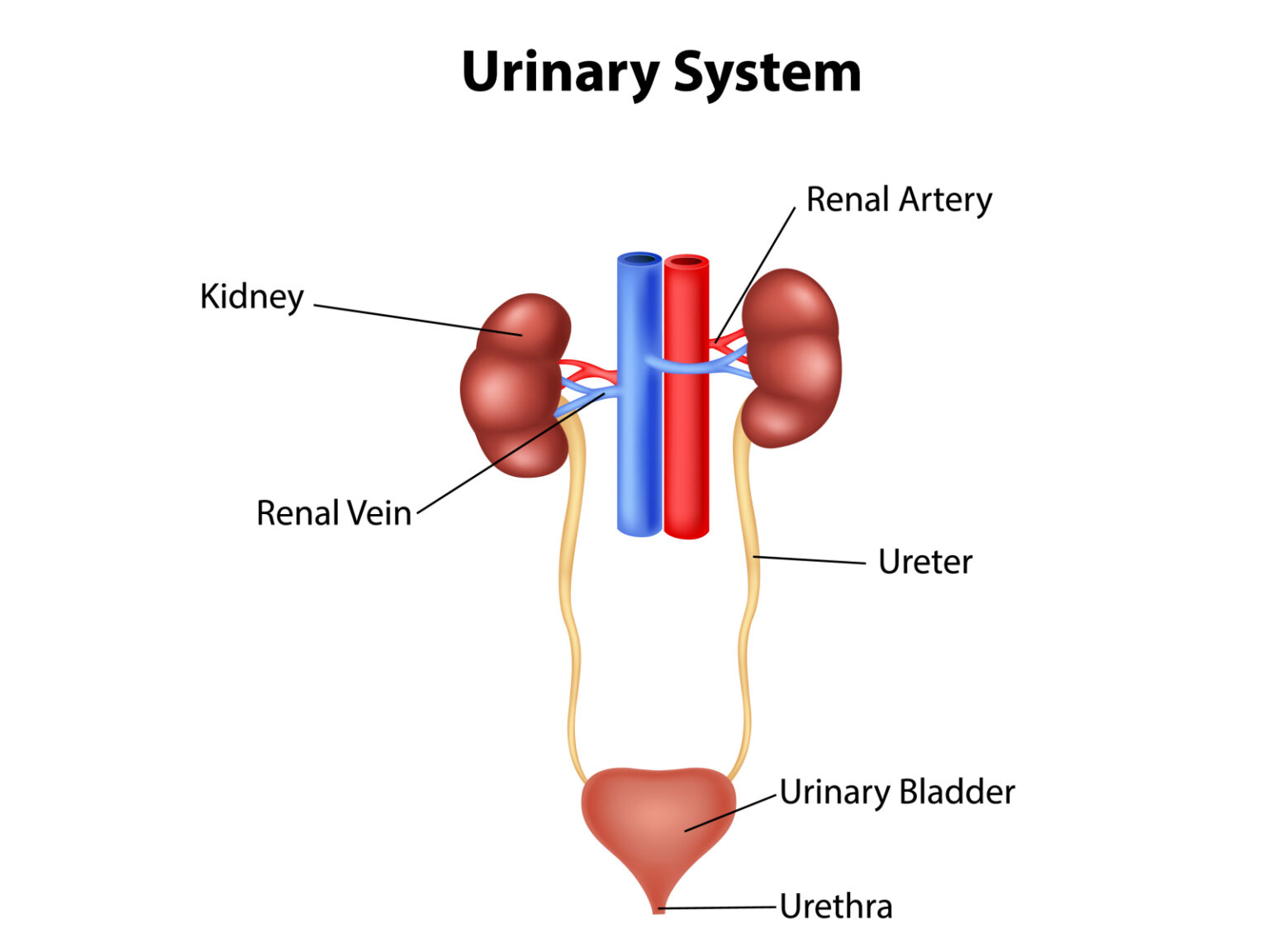 Hydronephrosis - Causes & Best Homeopathic Medicines