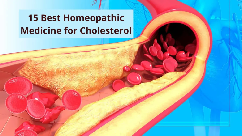 15 Best Homeopathic Medicine For Cholesterol