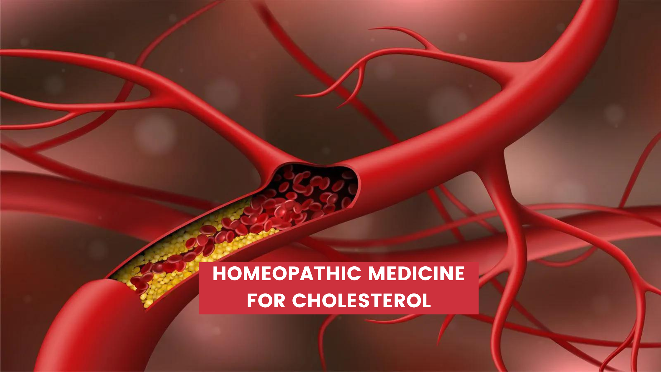 Homeopathic Medicine For Cholesterol