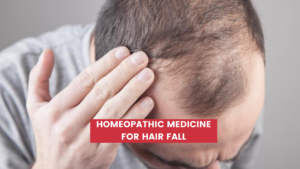 Homeopathic Medicine for Hair Fall