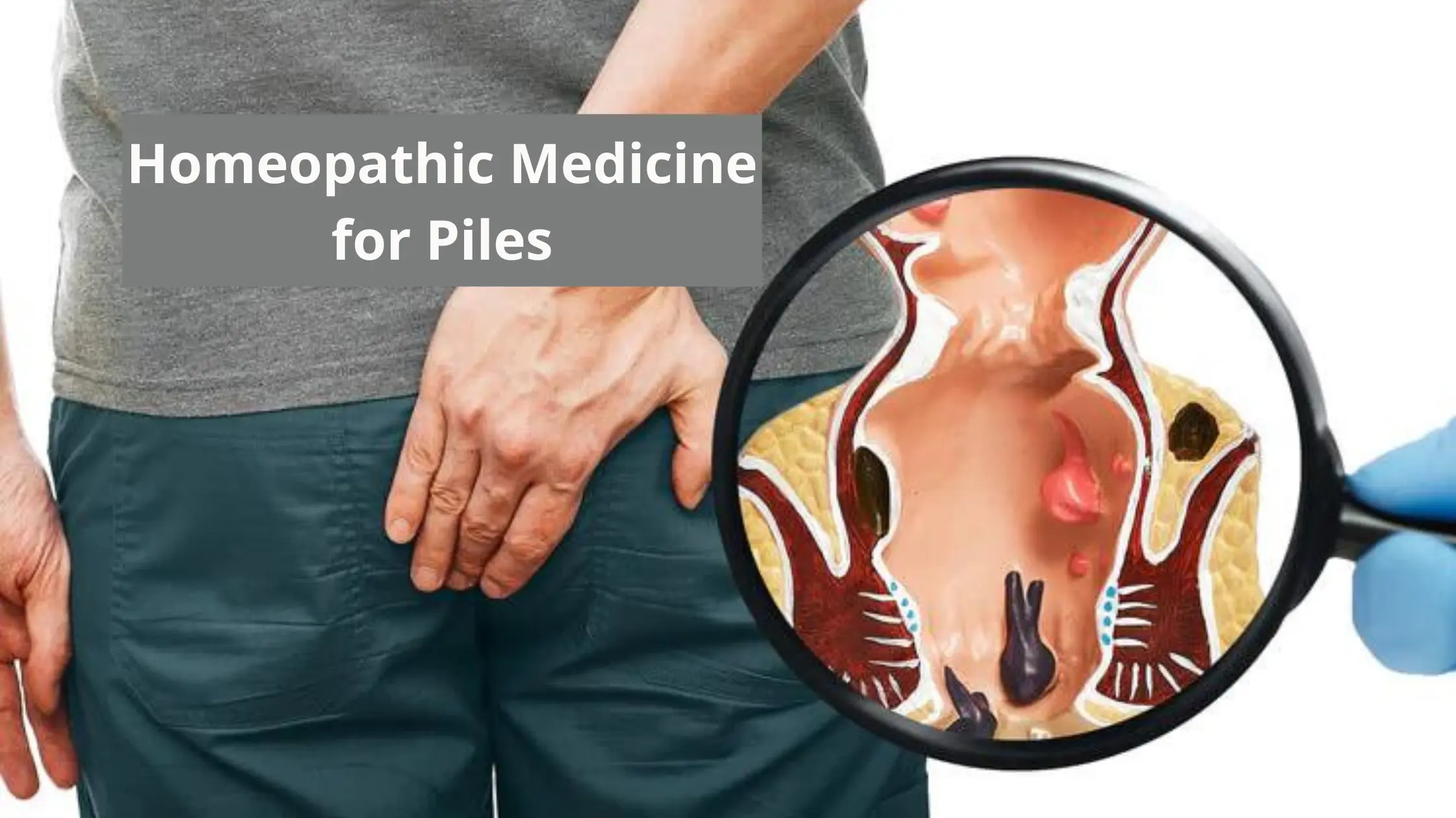 homeopathic medicine for piles