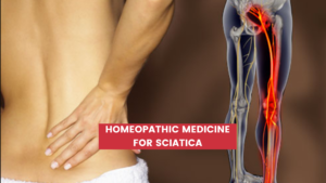 Homeopathic Medicine For Sciatica