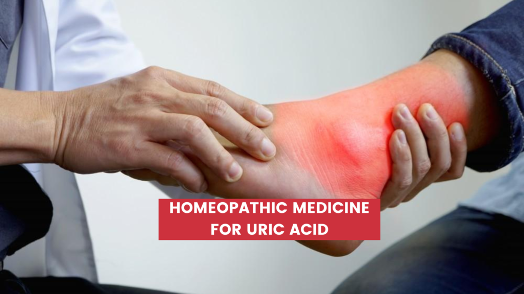 Homeopathic Medicine For Uric Acid