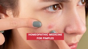 Homeopathic Medicine for Pimples