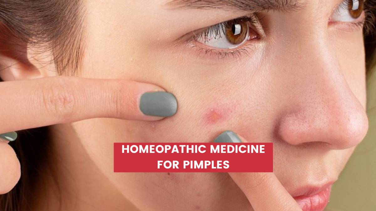 Top 10 Homeopathic Medicine For Pimples