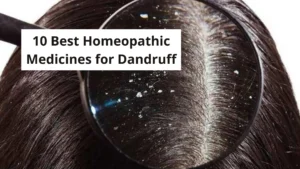 10 Best Homeopathic Medicine For Dandruff