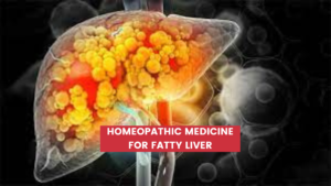 Homeopathic Medicine For Fatty Liver