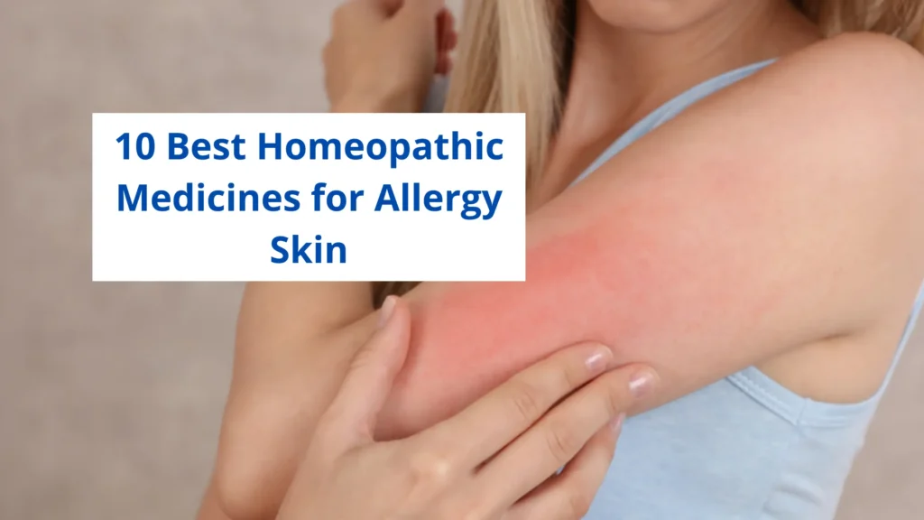 15 Best Homeopathic Medicine for Allergy Skin