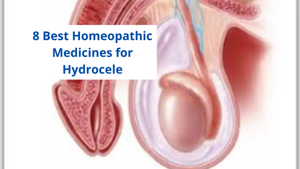 Homeopathic Medicine for hydrocele