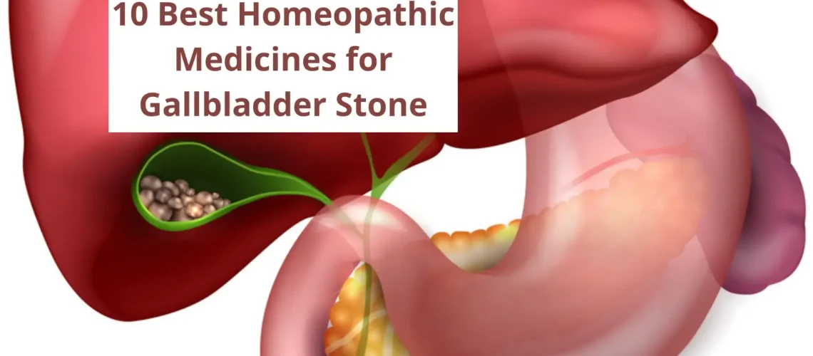 10 Best Homeopathic Medicine For Gallbladder Stone