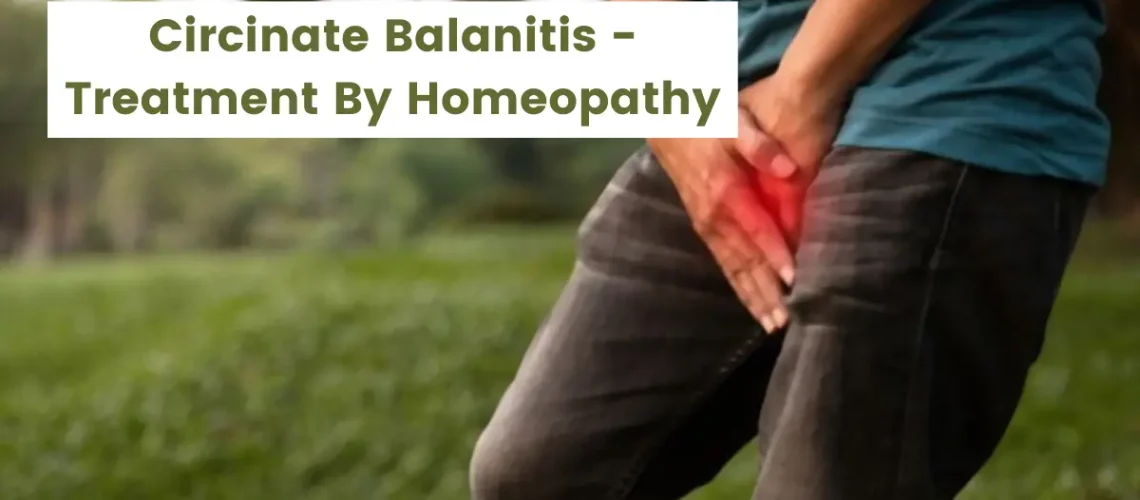 Circinate Balanitis - Causes and Best 10 Homeopathic Medicines