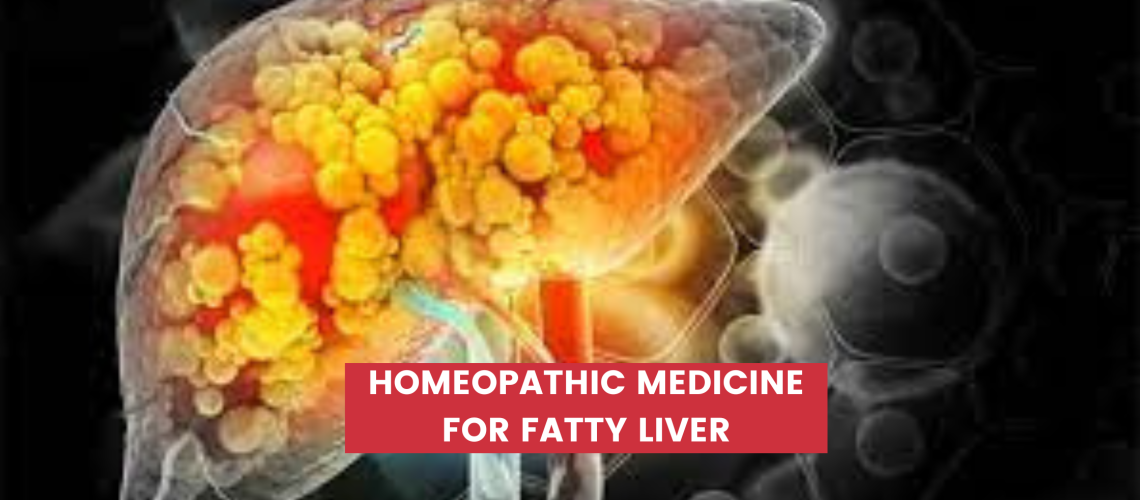 Homeopathic Medicine For Fatty Liver