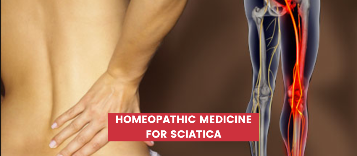 Homeopathic Medicine For Sciatica