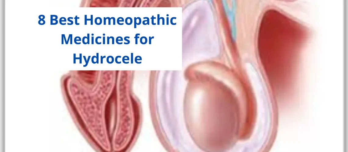 Homeopathic Medicine for hydrocele