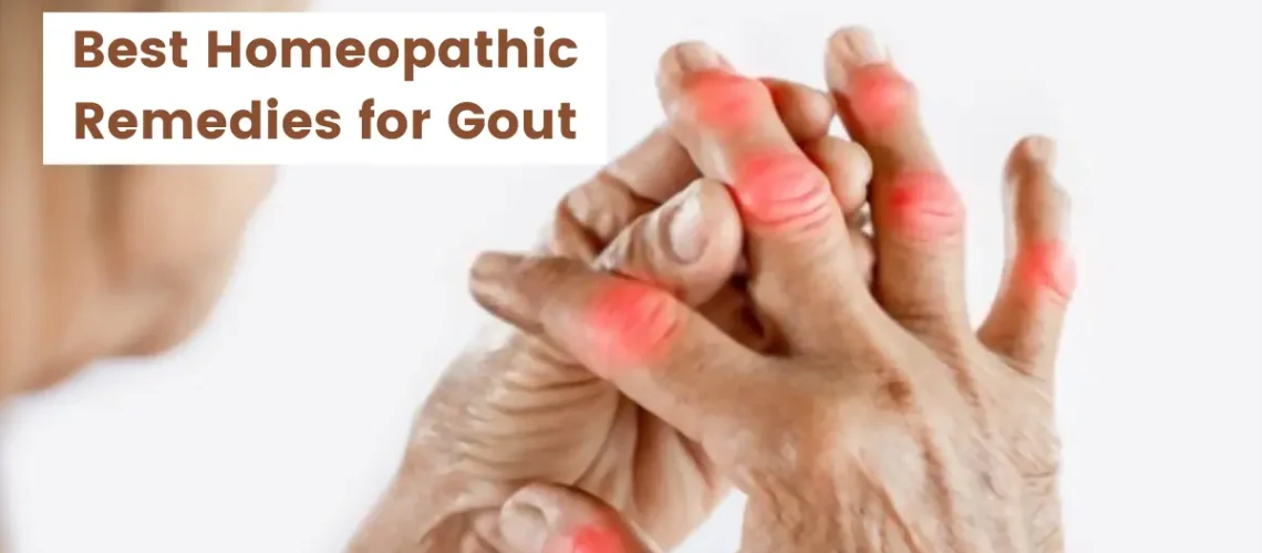 Homeopathy for Gout - Causes, Symptoms and Top 10 Medicines
